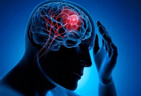 انواع جراحی مغز و اعصاب با جراح مغز و اعصاب