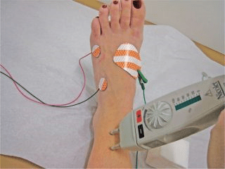 نوار عصب و عضله اطفال (EMG) چیست؟