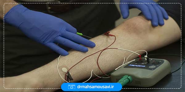 11 مزایای تست نوار عصب سیاتیک و نحوه انجام تست