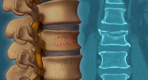 دکتر متخصص مغز و اعصاب خوب در اصفهان