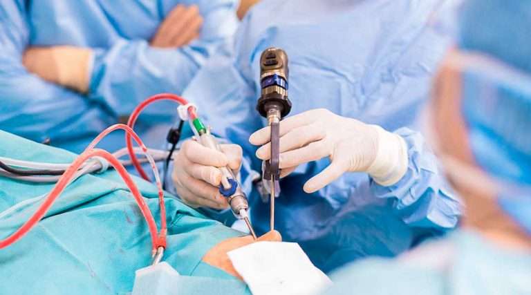جراحی اندوسکوپیک اندونازال حداقل تهاجمی