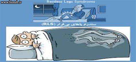 غده های قاعده ای و سندرم پای بی­قرار پس از سکته مغزی