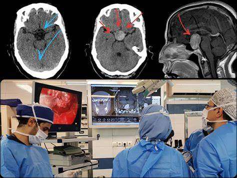 چرا جراحی مغز انجام می شود؟