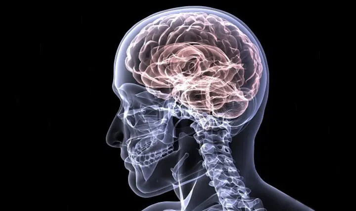 آیا آلزایمر و سردرد با هم مرتبط است؟