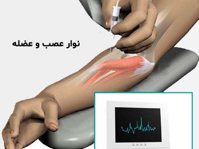 مراکز نوار عصب و عضله تامین اجتماعی