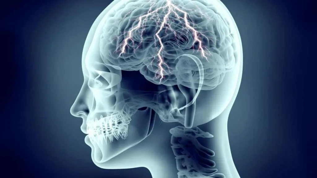 طب سوزنی برای سردرد: طب سوزنی برای سردرد نی نی سایت