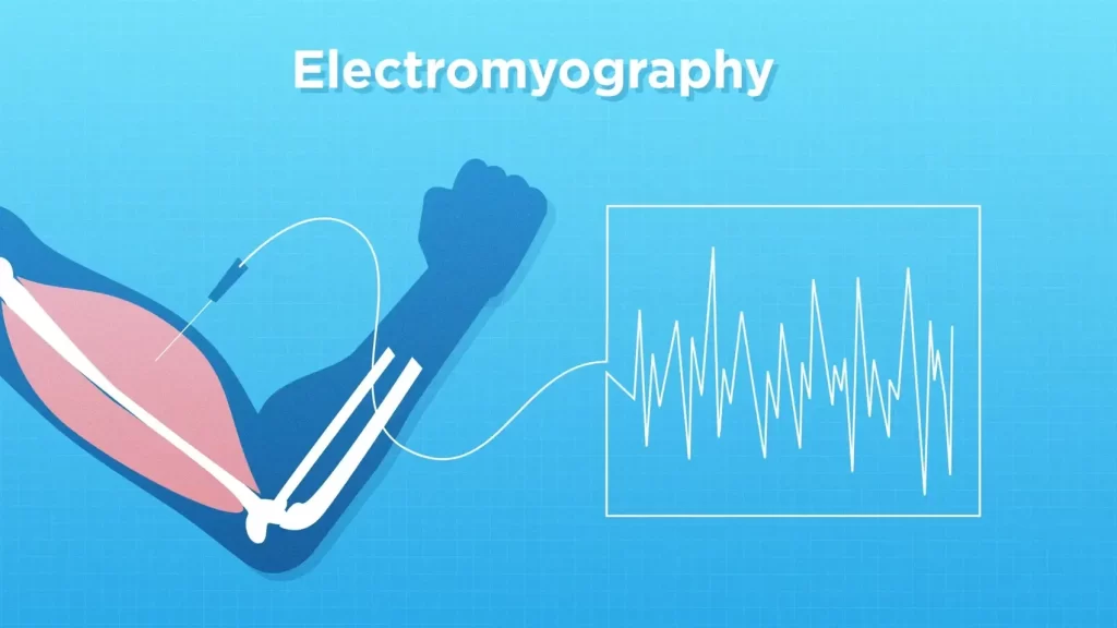 تفسیر EMG