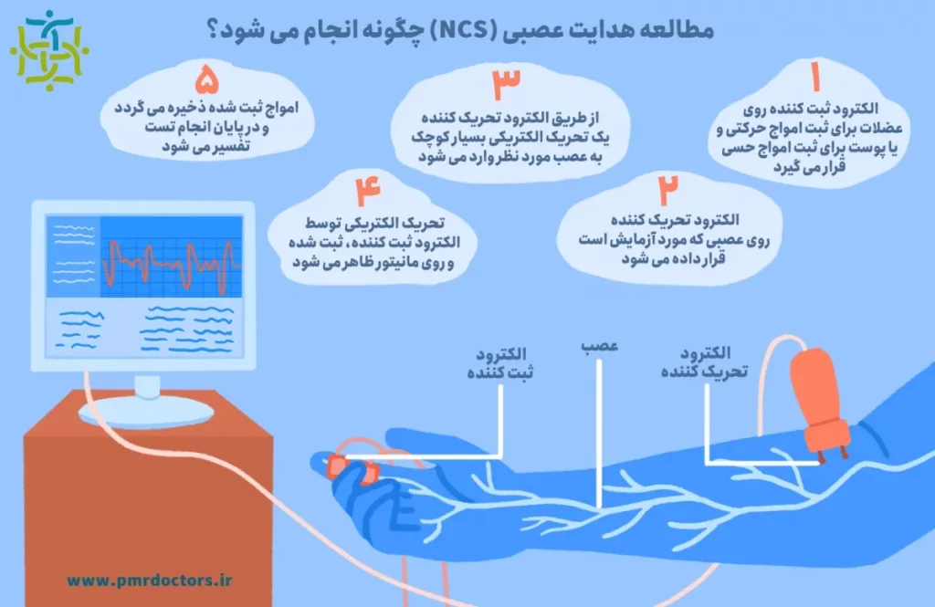 مطالعات هدایت عصبی