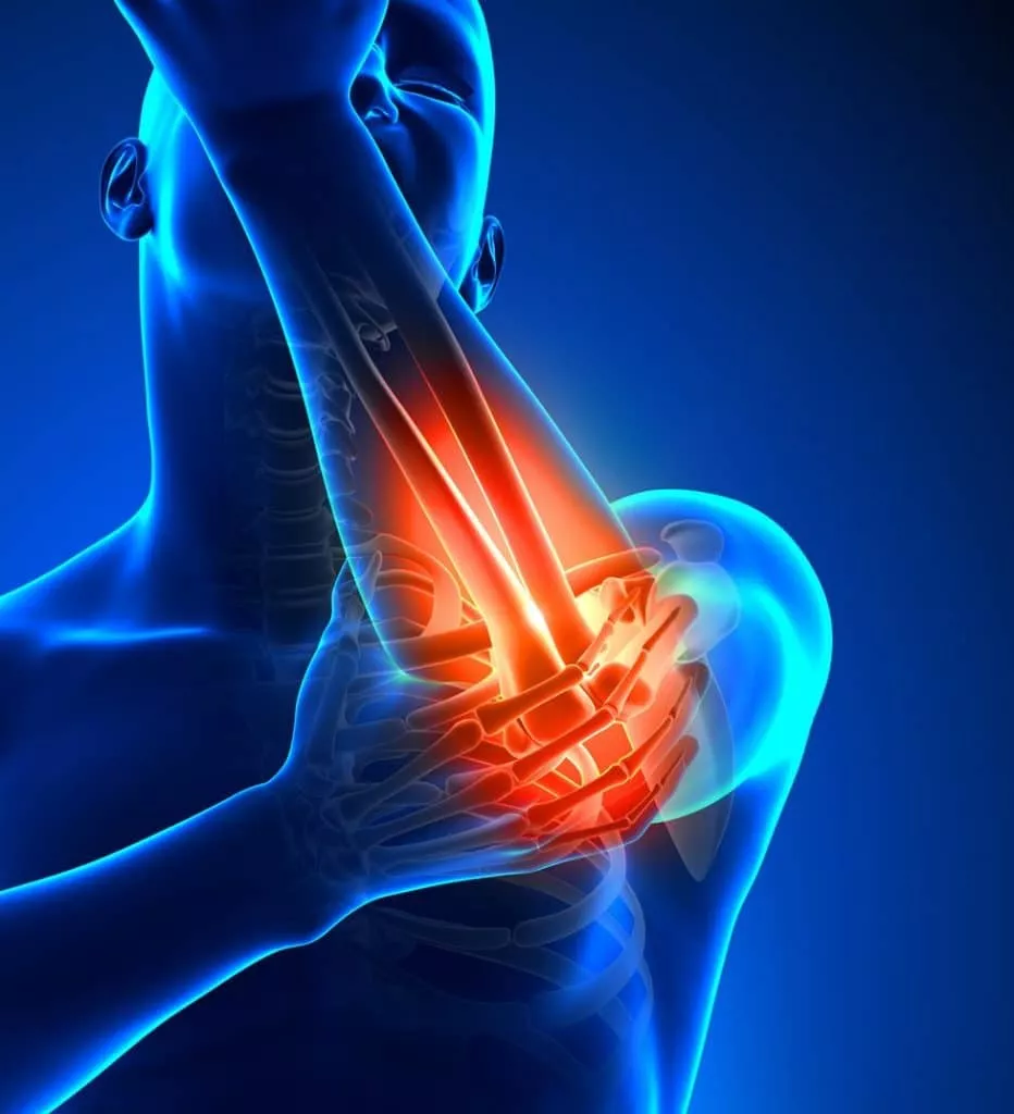 نوروپاتی اولنار در آرنج
