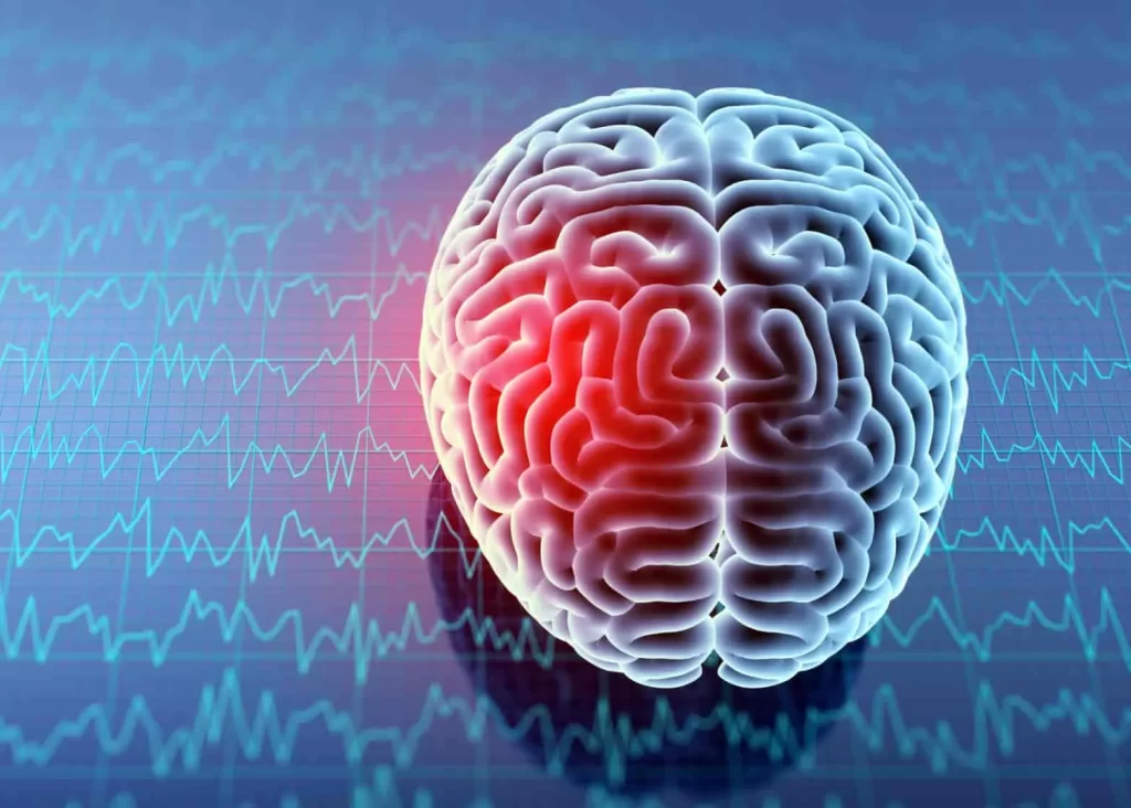 روش‌های تشخیص بیماری مغز و اعصاب با متخصص مغز و اعصاب خوب