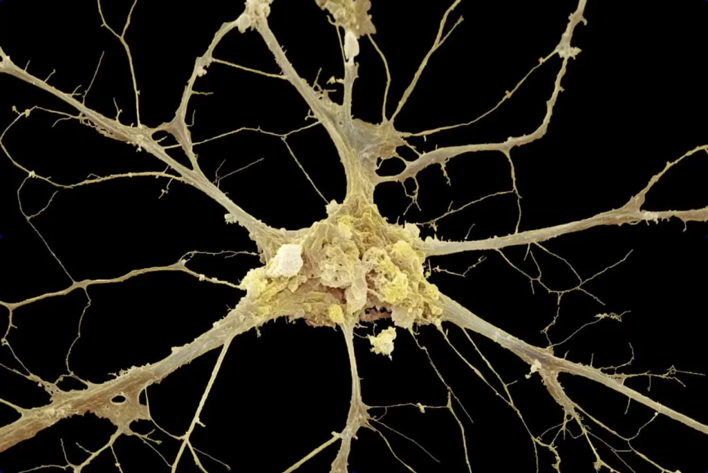 مشاوره نورولوژی چیست؟ تشخیص و درمان با متخصص مغز و اعصاب از خارج