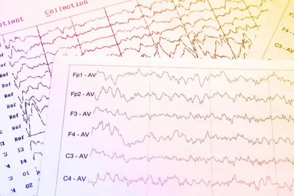 خطرات گرفتن نوار مغز یا الکتروانسفالوگرام (EEG) چیست؟