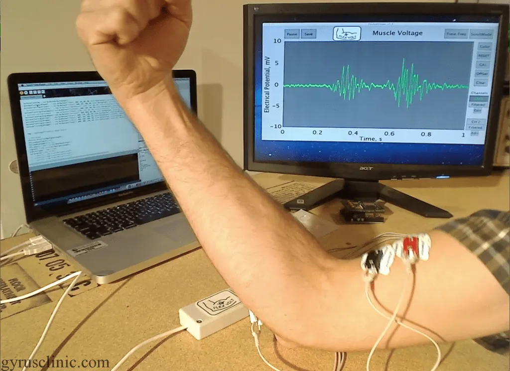 آنچه باید قبل از آزمایش EMG بدانید؟