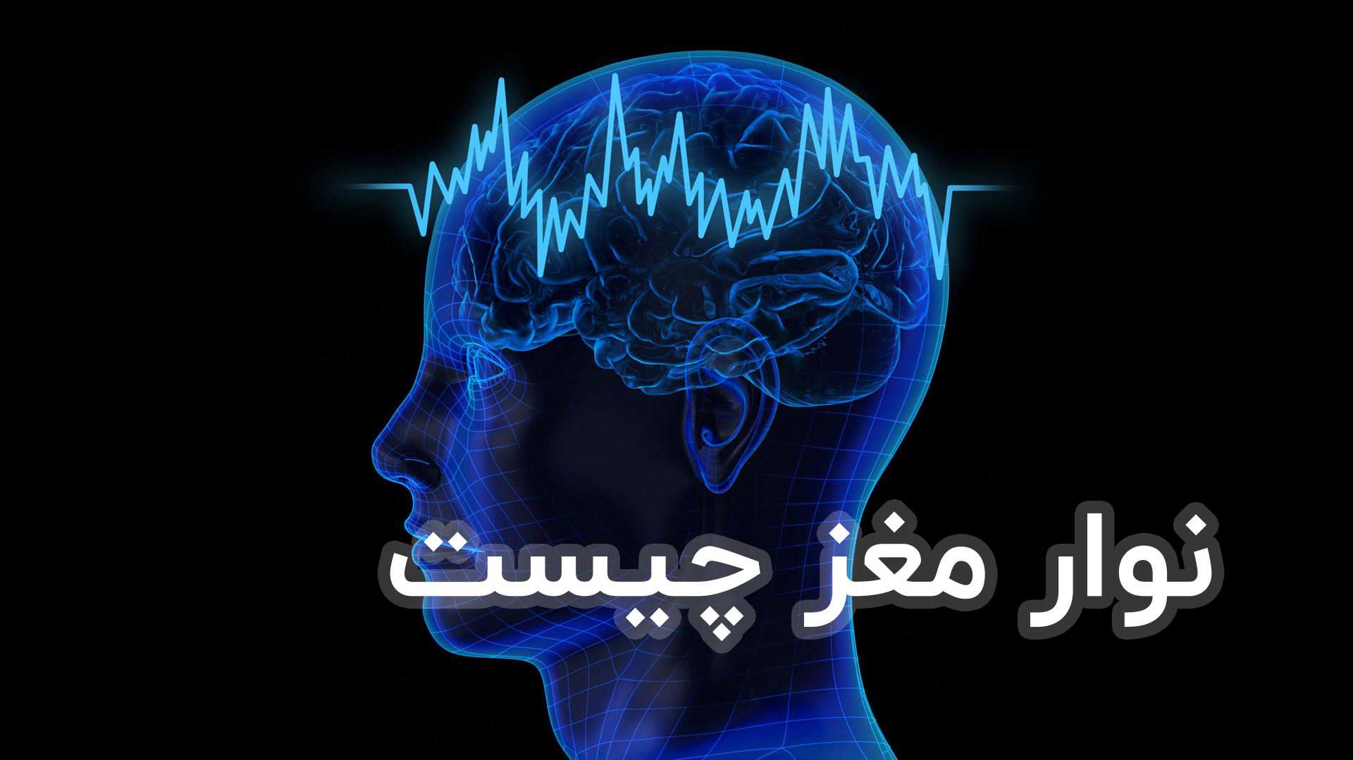 تفاوت نوار مغز سالم و ناسالم کلینیک تخصصی میگرن و سردرد