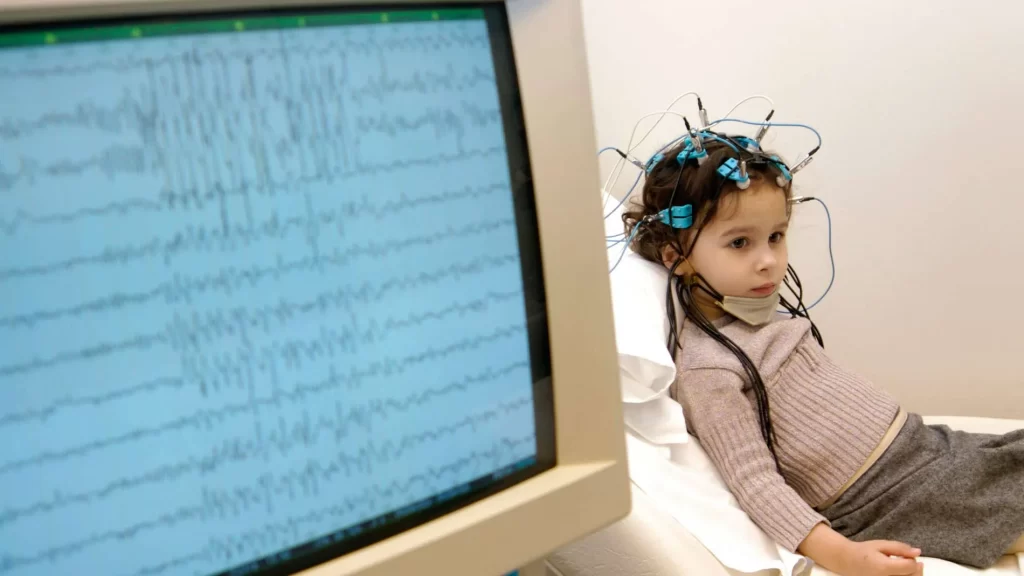 نحوه گرفتن نوار مغز یا الکتروانسفالوگرام (EEG) چگونه است؟ 