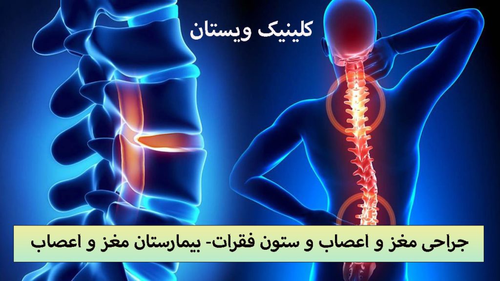 جراحی مغز و اعصاب تصویر دیجیتالی از ستون فقرات یک شخص که در قسمت گردن و کمر دچار درد است