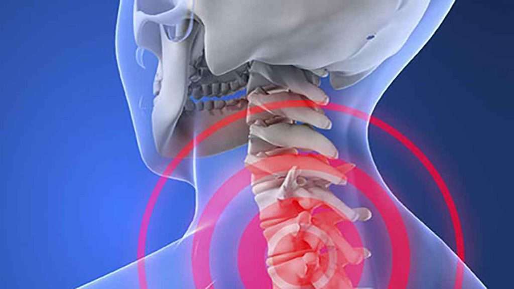 علائم آرتروز