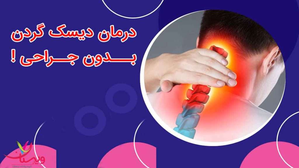 روش های درمان دیسک گردن