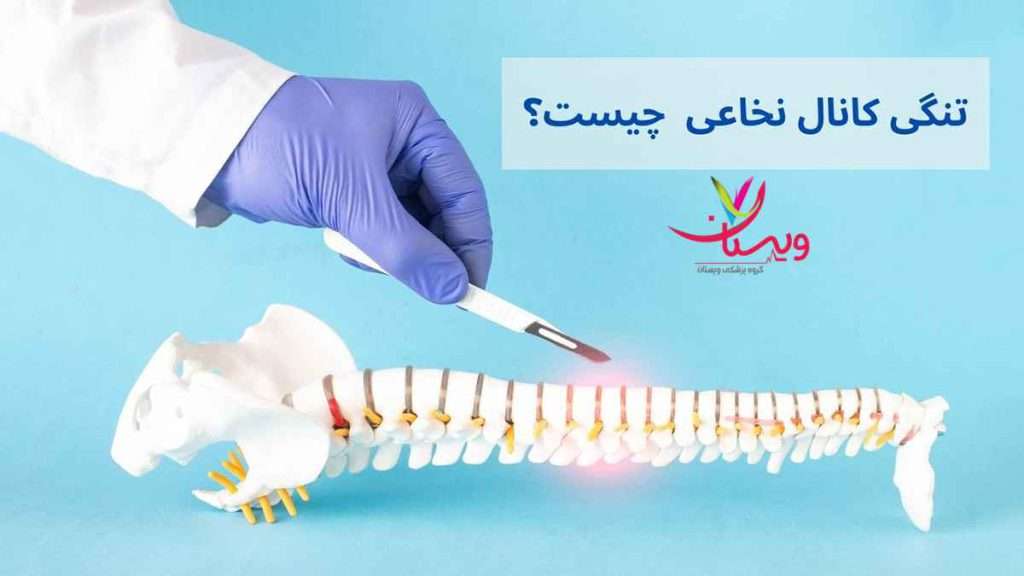 تنگی کانال نخاعی چیست