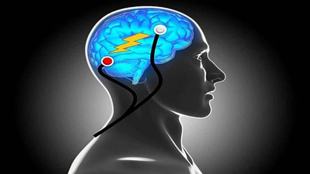 عوارض تحریک الکتریکی مغز