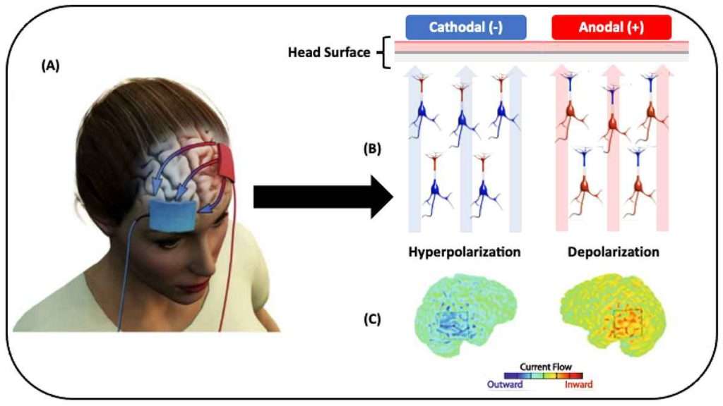 مزایا و معایبی TDCS 