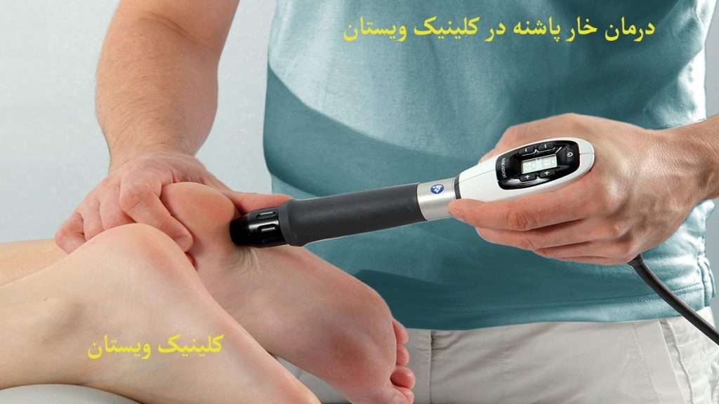 درمان خار پاشنه توسط پزشک