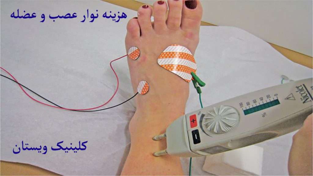 تست نوار عصب پا برای تشخیص مشکلات آن مورد استفاده قرار می گیرد