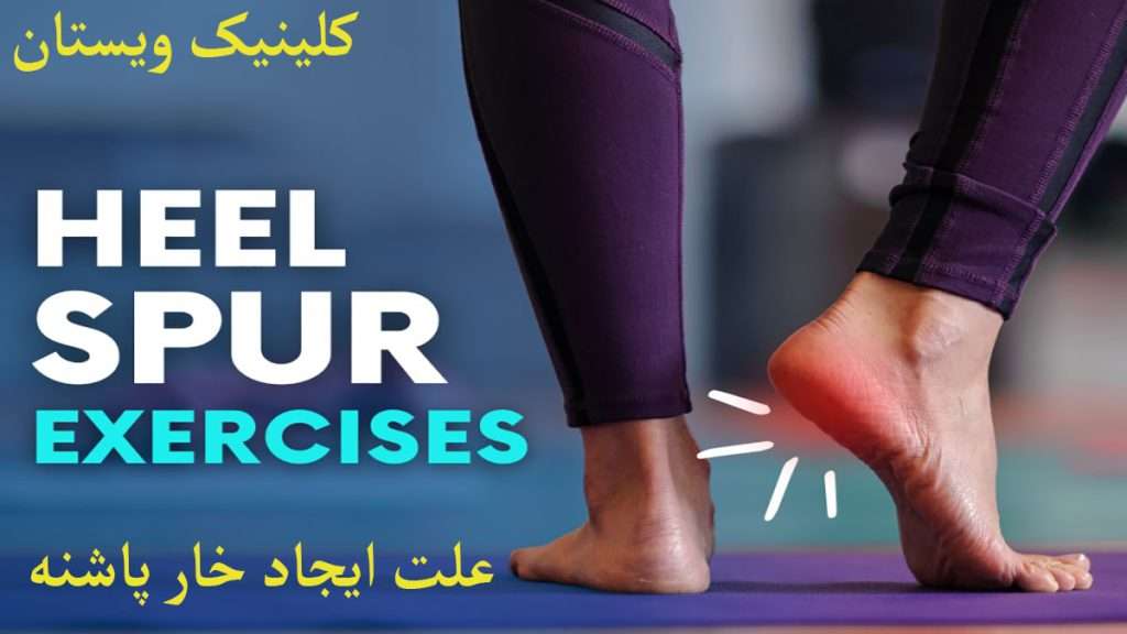 درد در ناحیه پاشنه به دلیل وجود خار پاشنه