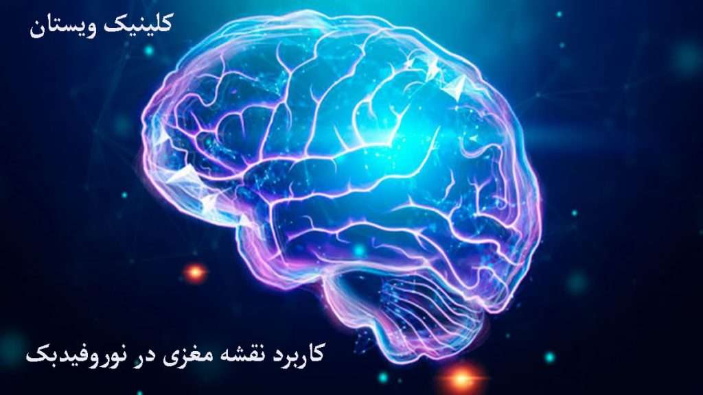 کاربرد نقشه مغزی جریان الکتریکی مغز نشان داده می شود