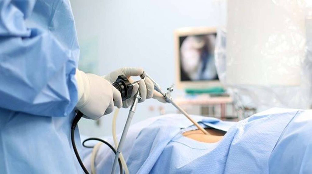 پزشک متخصص در حال انجام بوتاکس معده برای بیمار