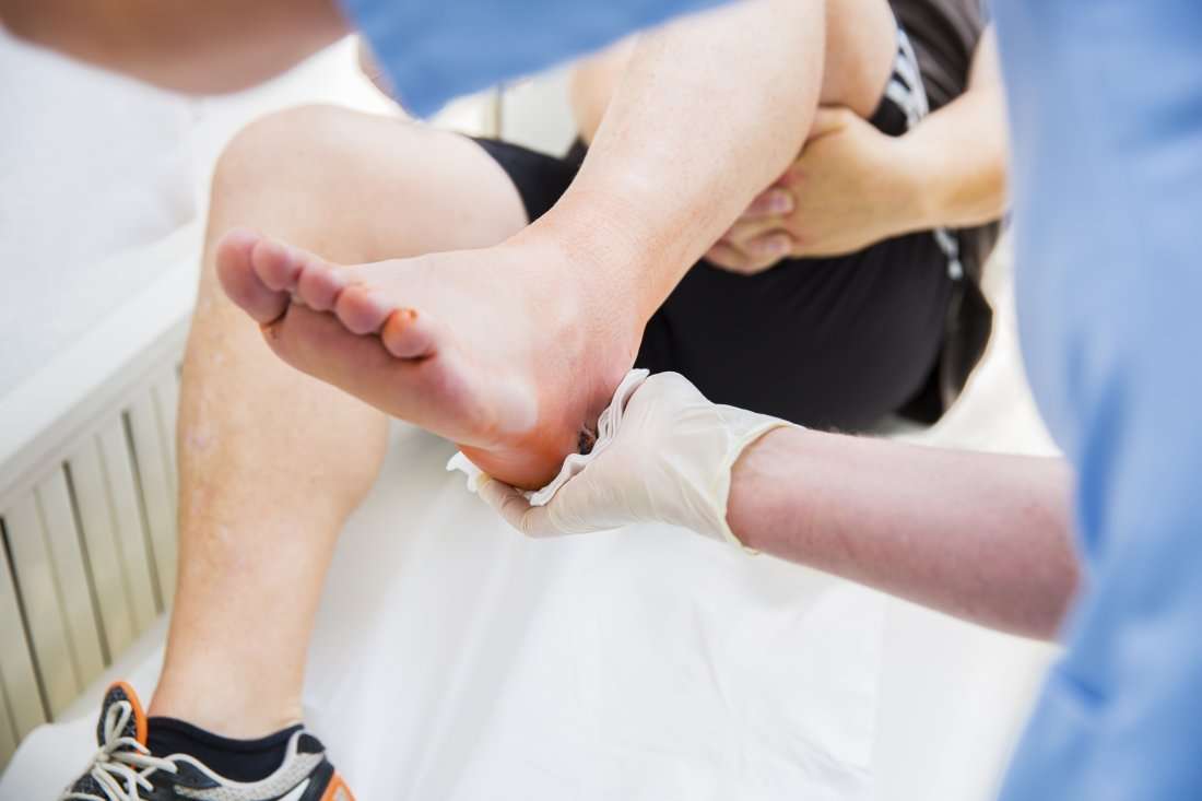 درمان کف پا با طب سنتی