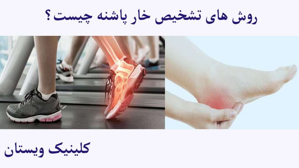 درد پاشنه پا هنگام راه رفتن