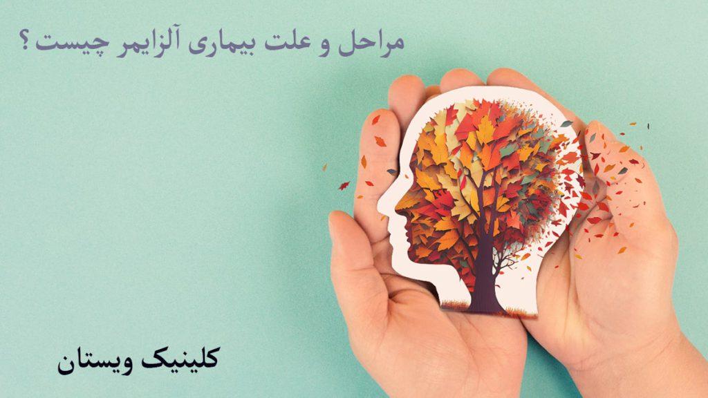 مراحل آلزایمر مغز انسان ونوشته ای در خصوص بیماری آلزایمر نمایش داده میشود