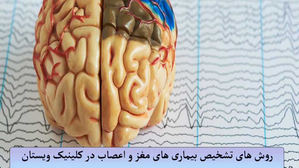 تشخیص بیماری های مغز و اعصاب نوار مغز و ماژول مغز نمایش داده می وشد