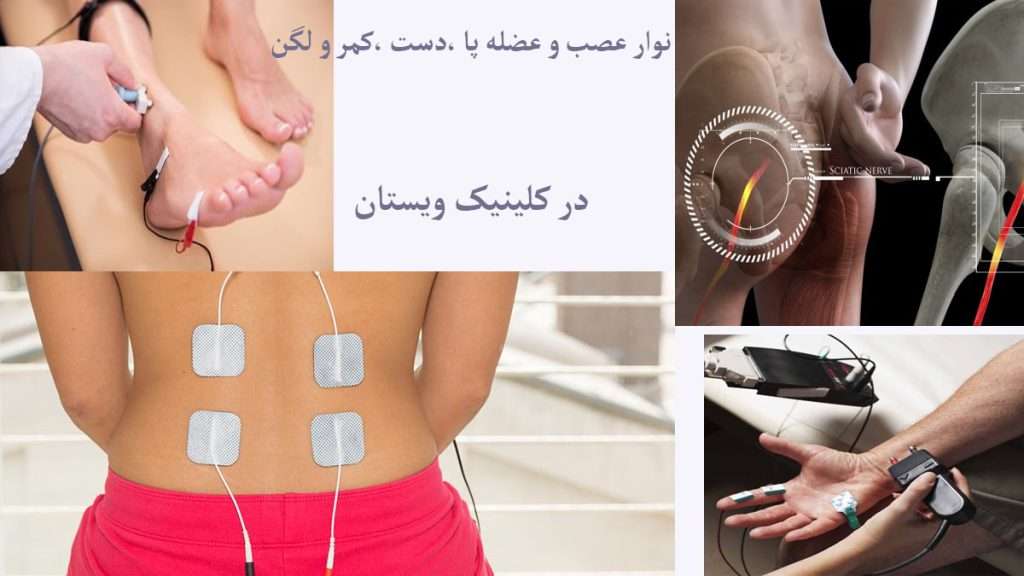 نوار عصب و عضله برای پا ، دست ، کمر و لگن