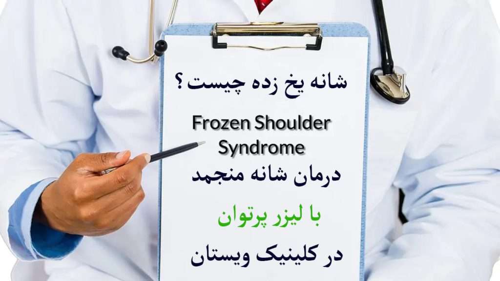 نوشته ای درباره شانه یخ زده چیست و درمان شانه یخ زده
