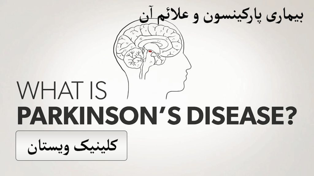 بیماری پارکینسون نوشته در خصوص بیماری پارکینسون