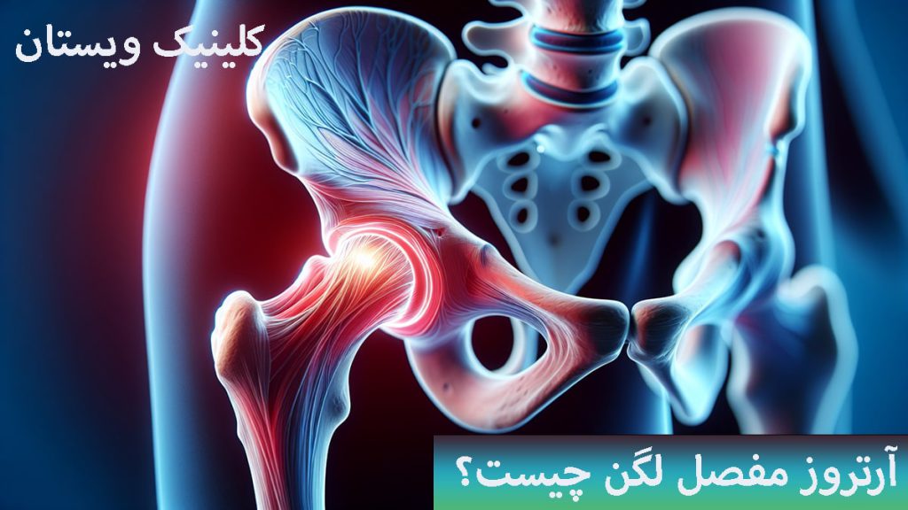 آرتروز مفصل لگن مفصل لگن نشان داده می شود-عکس بصوری دیجیتالی است