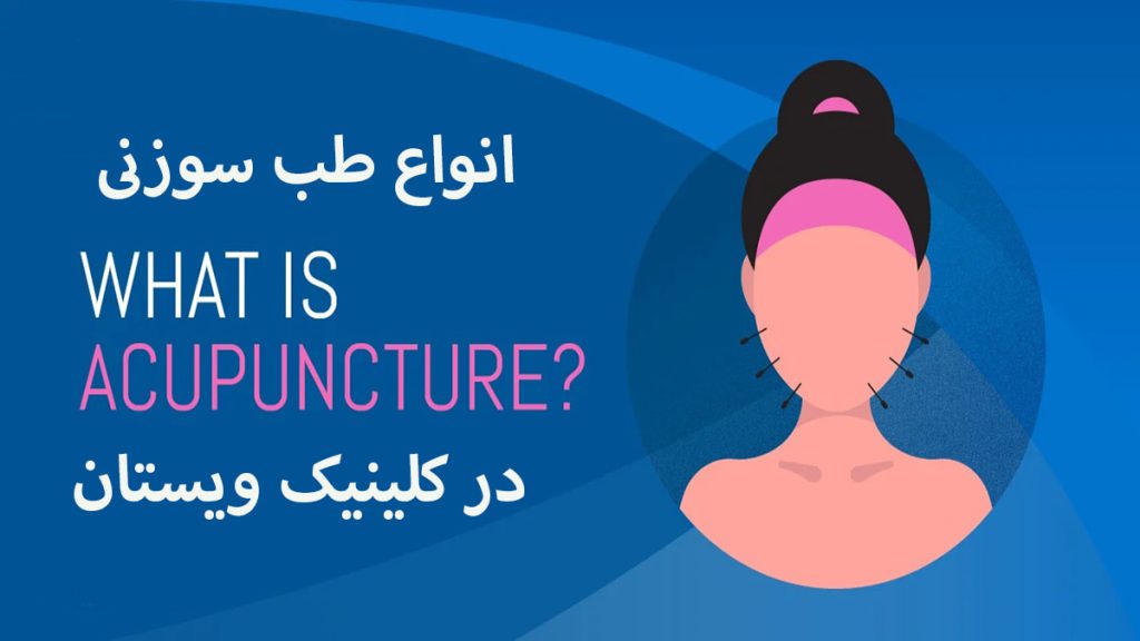 یک تصویر نمادین از یک خانم در سمت راست و یک نوشته با عنوان انواع طب سوزنی