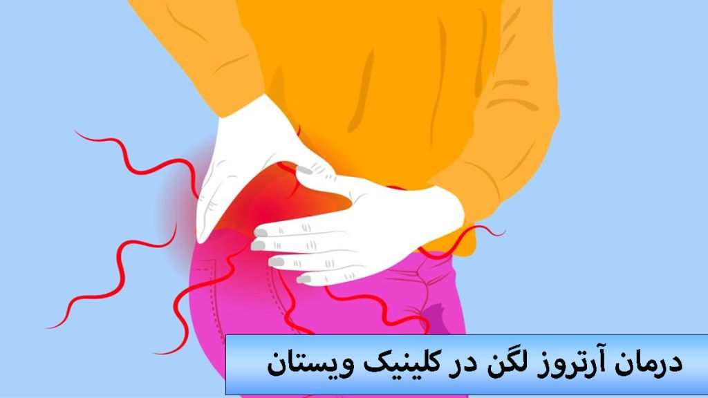 تصویری انیمیشنی از یک فرد که لگن او درد می کند