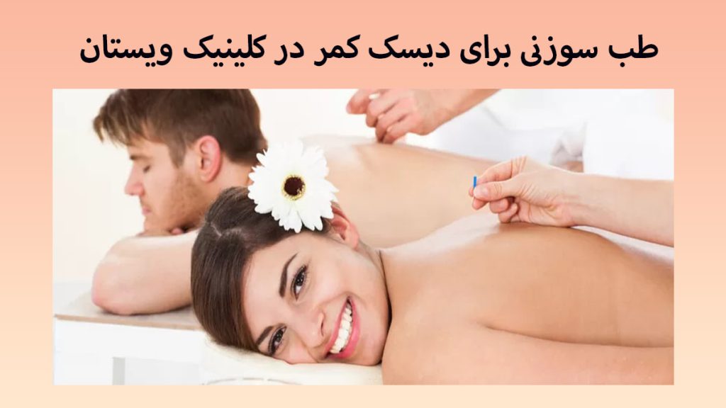 دو شخص یک خانم و یک آقا که در حال انجام طب سوزنی کمر هستند