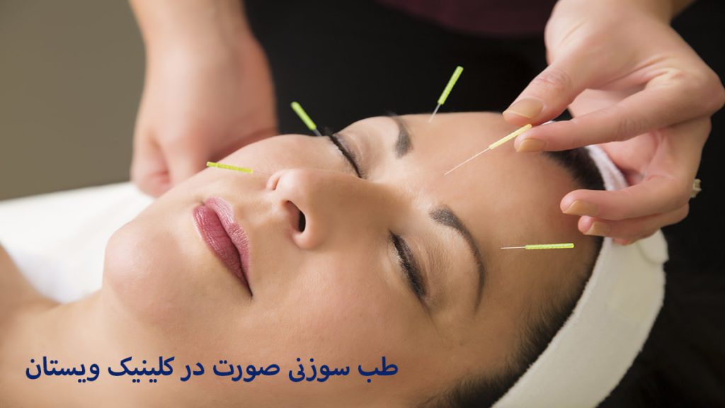 پزشک در حال انجام طب سوزنی صورت برای یک خانم
