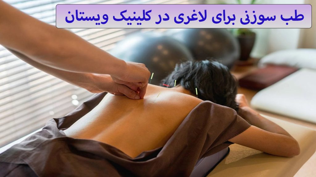 یک خانم بر روی تختی دراز کشیده و پزشک در حال انجام طب سوزنی برای او می باشد