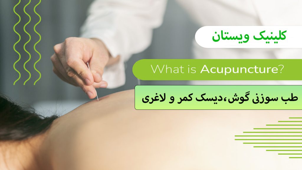 یک پزشک در حا انجام طب سوزنی