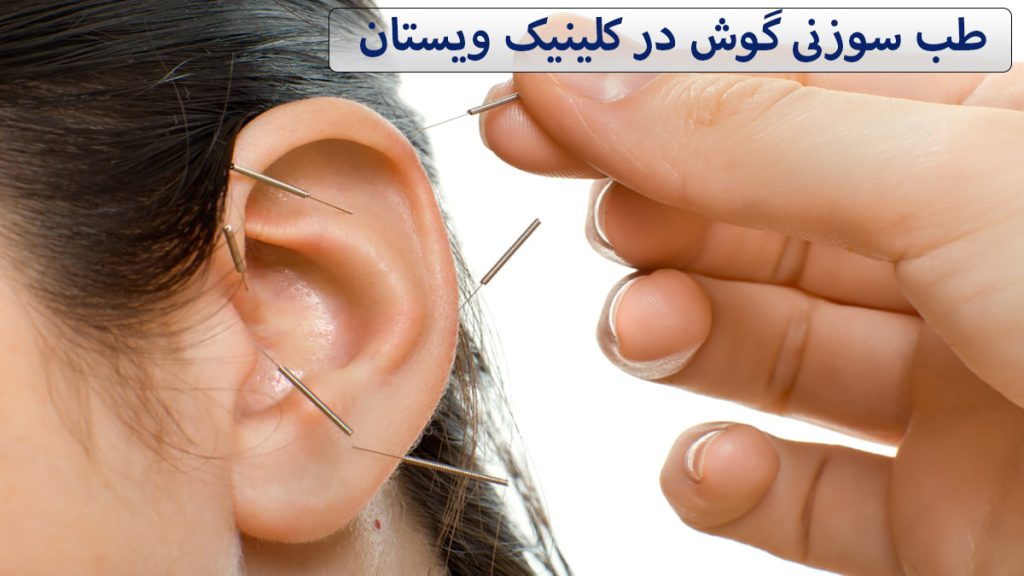 پزشک در حال انجام طب سوزنی گوش یک شخص است