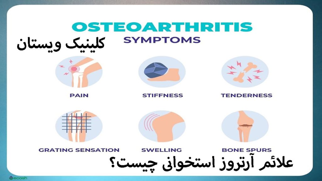 چند تصویر مختلف از استخوان و ابتلا به آرتروز