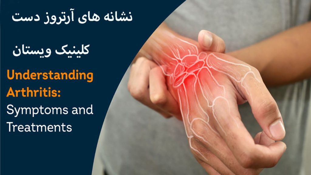 دست یک شخص که به آرتروز مبتلا شده است