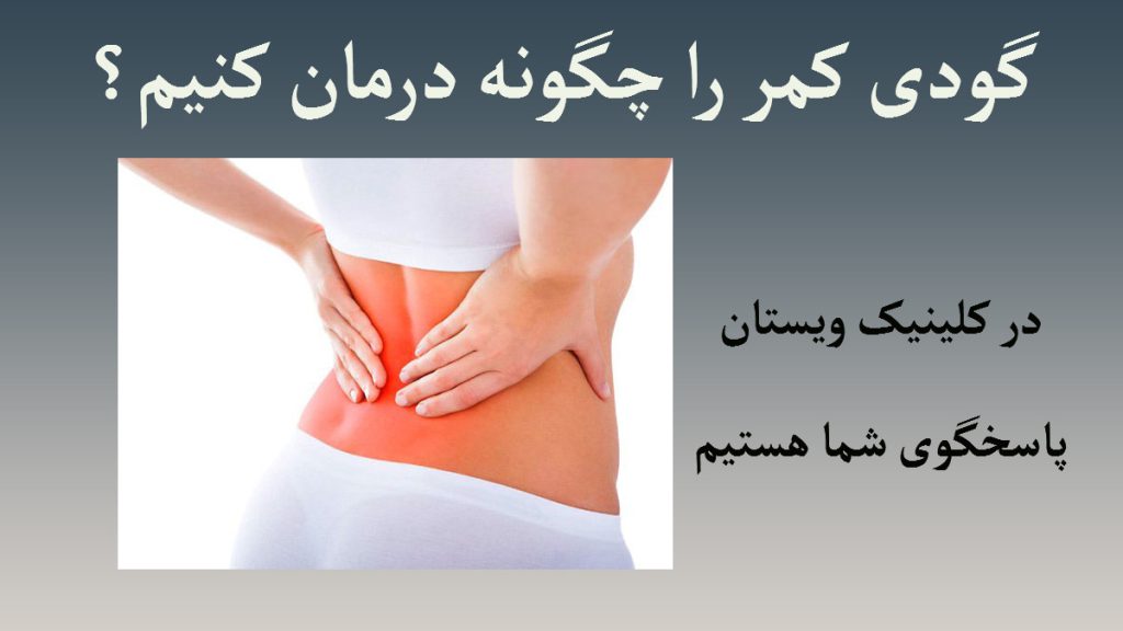 یک خانم که به دلیل داشتن کمردرد دستش را روی کمر گذاشته است