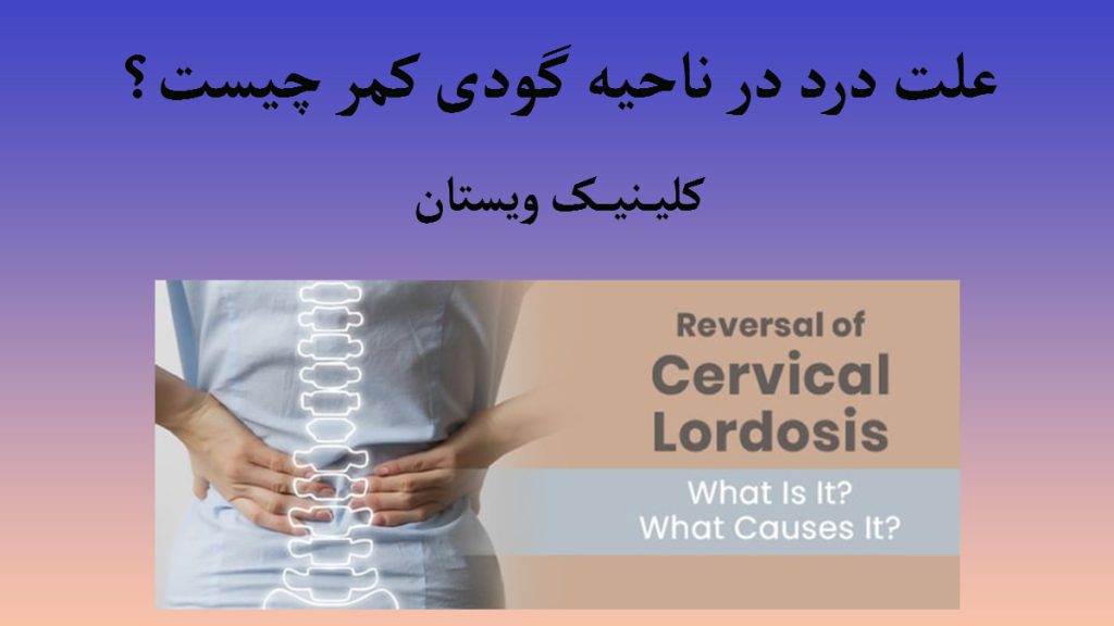 شخصی که ستون فقرات او به طور واضح ومشخص شده است