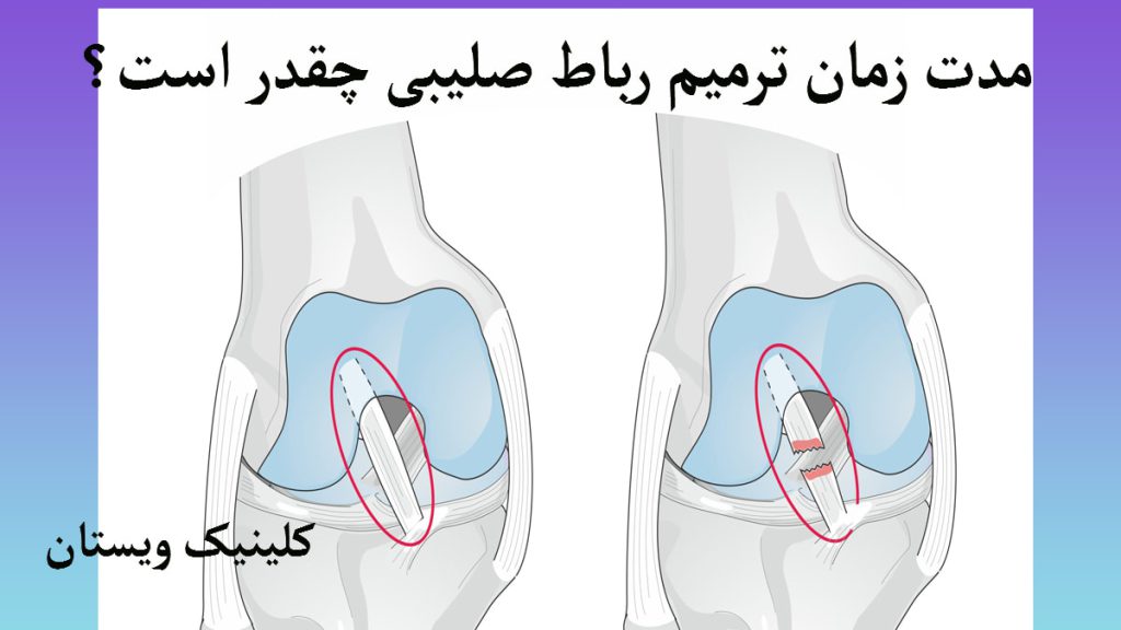 یک رباط صلیبی سالم و یک رباط صلیبی پاره شده نشان داده می شود
